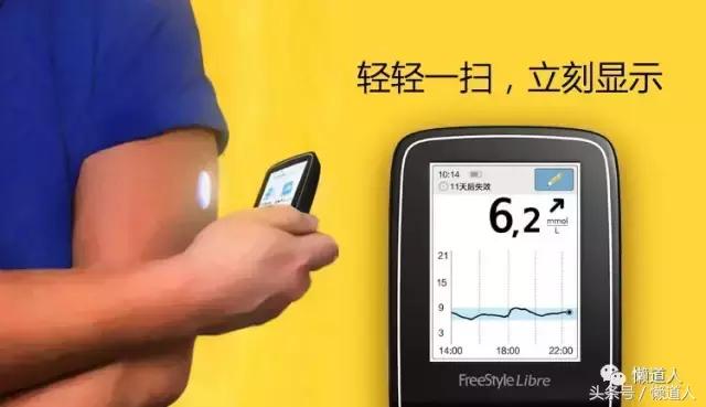 雅培瞬感觉不准可以校正吗,雅培瞬感刚开始准确吗