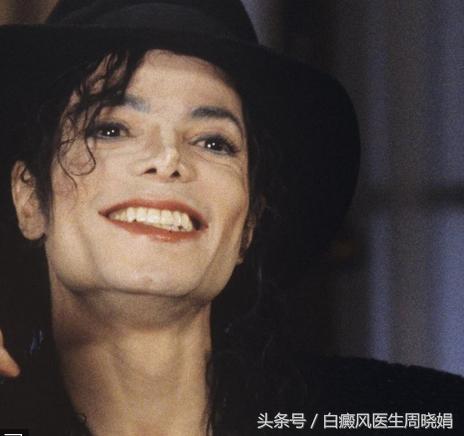 白癜风明星有哪些,白癜风明星