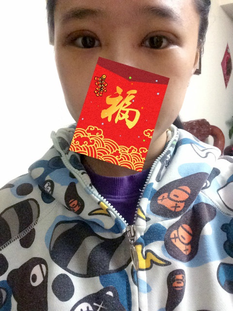 全切双眼皮20天了还一大一小,全切双眼皮的第二个月不来大姨妈