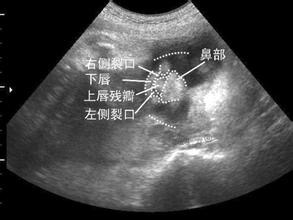 孕期检查发现宝宝有问题咋办,孕期检查出胎儿有缺陷怎么办