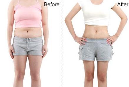 抽脂减肥解决上臂肥胖的烦恼,腹部肥胖很厚不做抽脂可以减掉吗