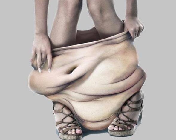 抽脂减肥解决上臂肥胖的烦恼,腹部肥胖很厚不做抽脂可以减掉吗