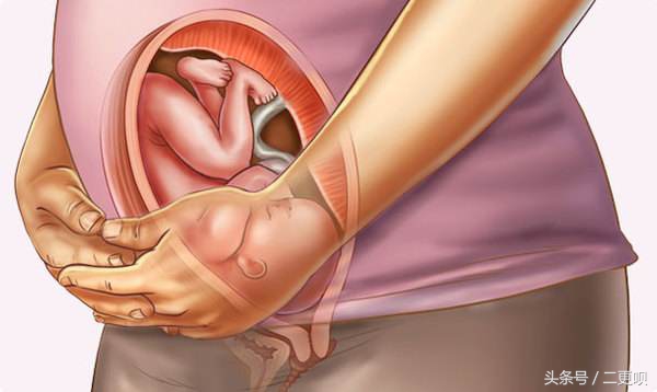 孕妈都担心羊水破？羊水破的问题看这篇你肯定就知道怎么做了