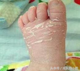 新手妈妈看到自己宝宝就烦,新生儿7个常见的生理现象