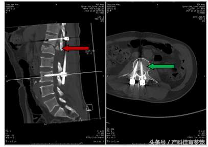 厉害了，这些骨科医生——306医院骨科成功救治非洲务工者