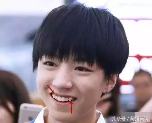 隐适美隐形矫正摘戴、保养注意事项全攻略