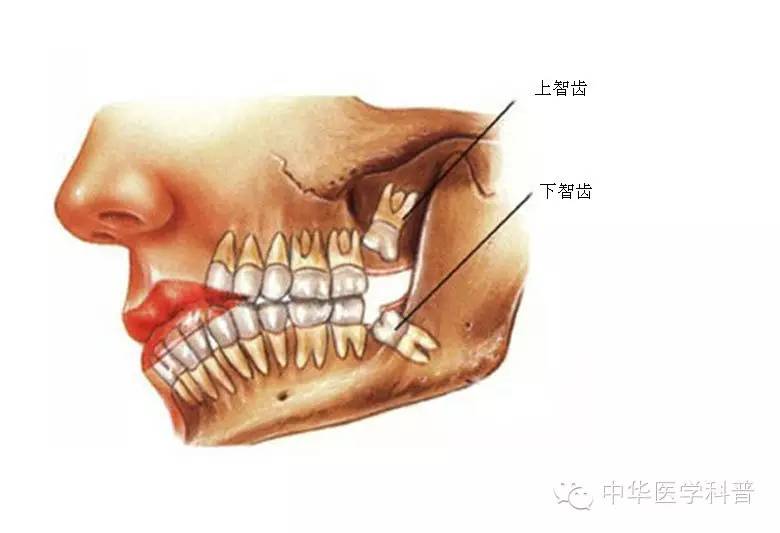 长智齿朋友圈说说心情,智齿的说说