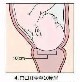 生娃打开宫口的流程,孕妇宫口开1指到生需要多久