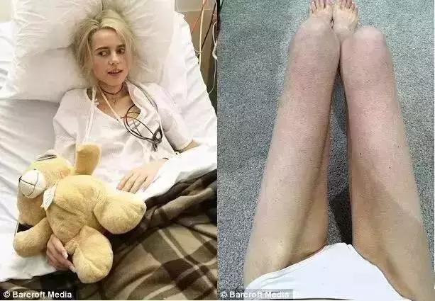 节食减肥的后果太可怕了图片,减肥路上总有些毒瘤