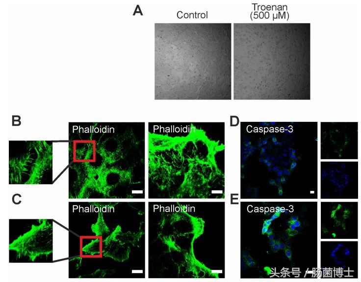 香氛疗法？有望成为结直肠癌治疗的一种新方法