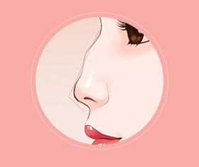 蒜头鼻鼻基底凹陷嘴凸,蒜头鼻和鹰钩鼻图片