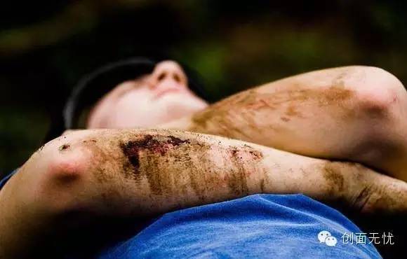 骑行伤口的处理方法,户外骑行不伤膝盖的正确方法