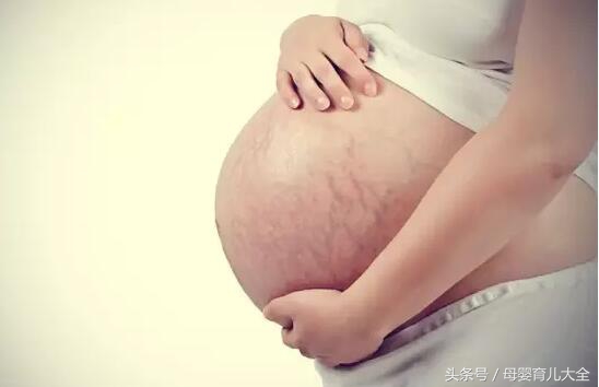 怀孕后有妊娠纹,怀孕几个月会长妊娠纹