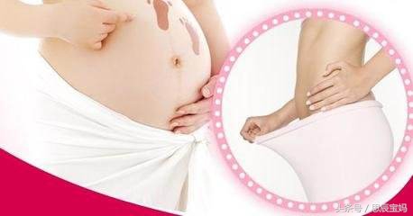 剖腹产后收腹带什么时候用,剖腹产后多久使用收腹带