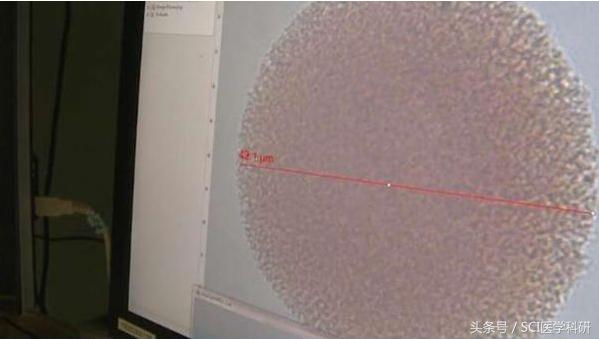 转移性恶性黑色素瘤有效治疗方法,黑色素瘤新型靶向疗法有望开发