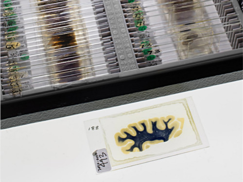 你有考虑过将来捐献器官救人吗,陈天桥为什么执着脑科学研究