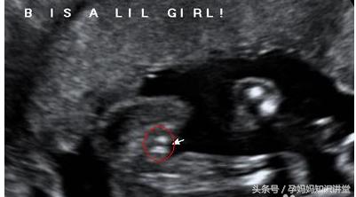 孕四个月的b超图怎么看,怎么看b超单判断胎儿怀孕