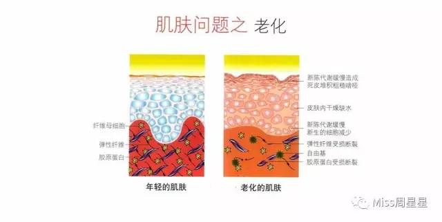 提拉紧致抗衰老美肤仪,提拉紧致美容仪效果最好的