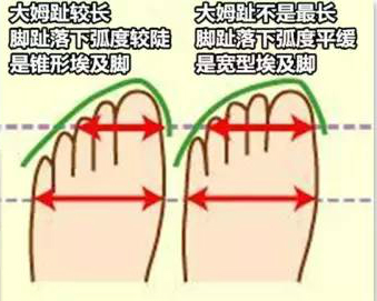 什么鞋适合中国人的脚型,每个人适合的鞋型