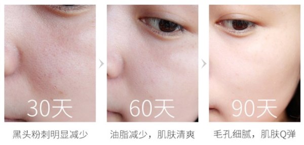 娜丽丝爽肤水缩毛孔,娜丽丝毛孔收敛水