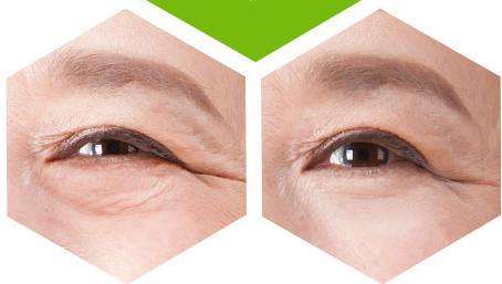 你的眼霜用对了吗,你的眼霜擦对了吗