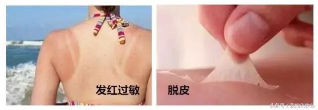 防晒要趁早别让晒黑毁了你的脸,防晒真的能让人不被晒黑吗