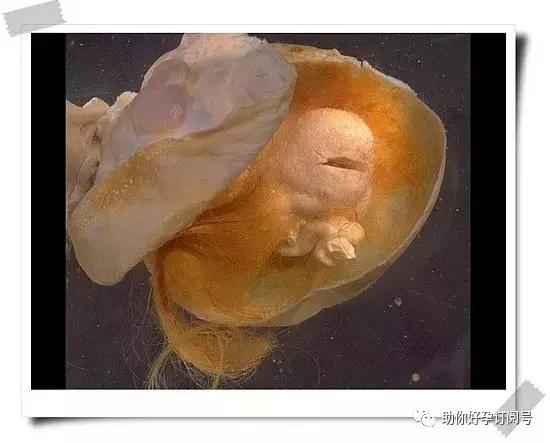 畸胎瘤的症状及治疗方法,五厘米的畸胎瘤有什么症状