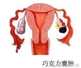 痛经结了婚以后会不会好点,为什么结婚后可以缓解痛经