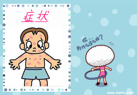 未接种疫苗的小孩需要备什么药,幼儿水痘预防知识宣传视频