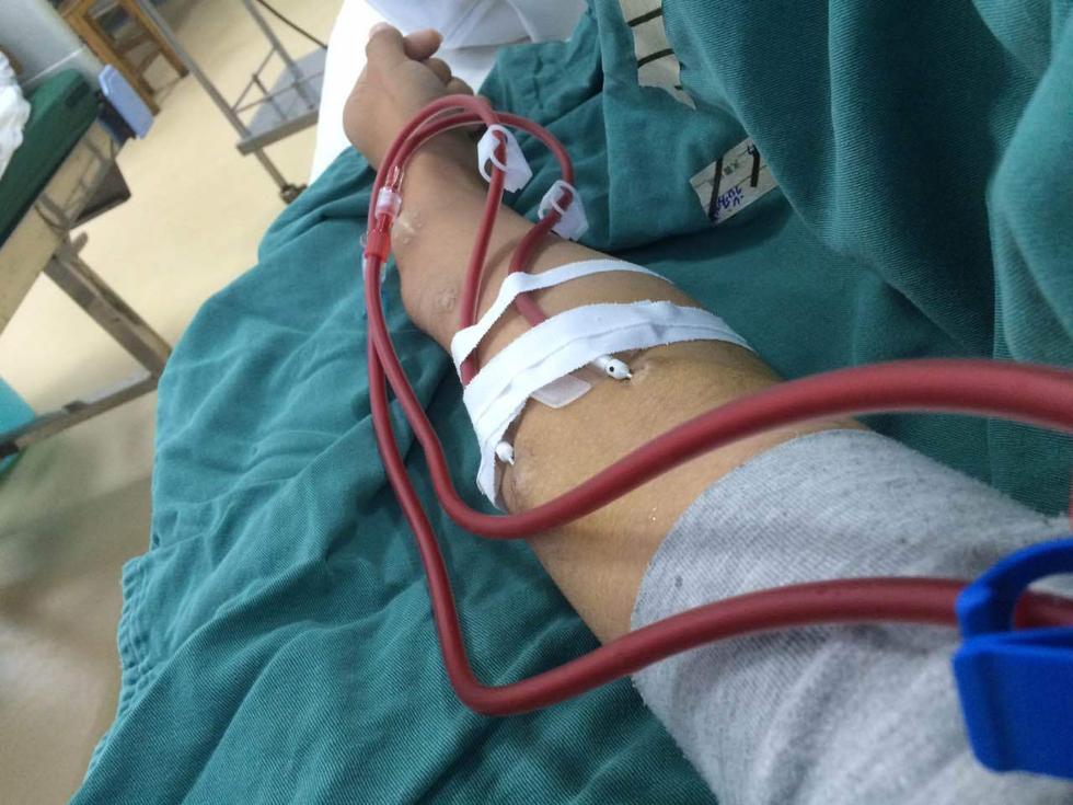 尿毒症透析到底有多痛苦,负债累累又得了尿毒症如何翻身