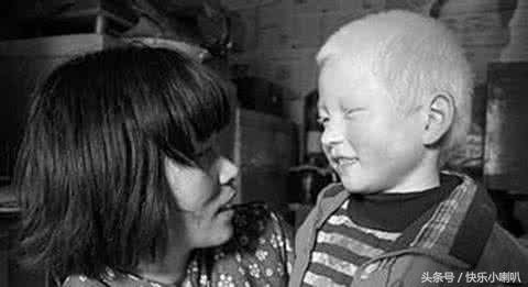 为何越来越多“少年白”？智者如斯也