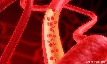 贫血与低血压有关联吗,贫血与低血压并存先治哪个