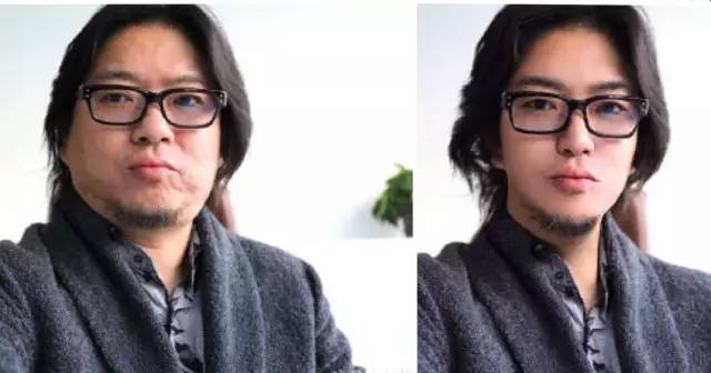 如何打造高鼻梁和小v脸,告别大饼脸