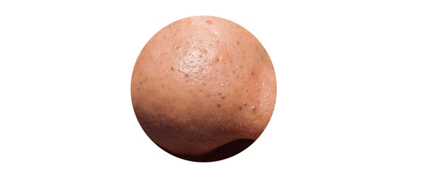 一篇没有噱头不抓眼球但缺切实有用的抗痘护理文章，给有需要的你