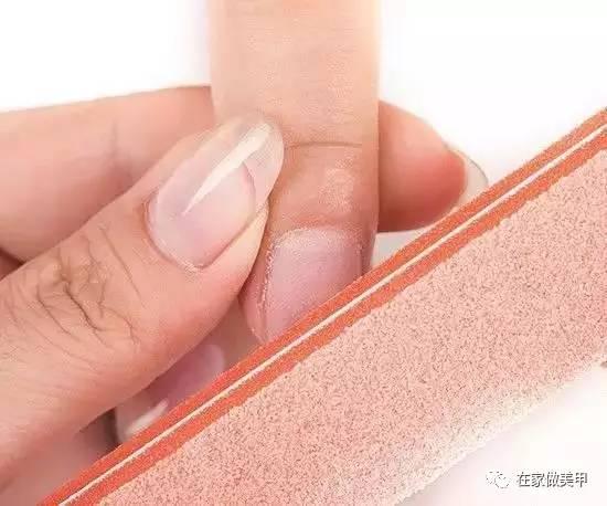 玛蒂被折断手指,玛蒂折断手指