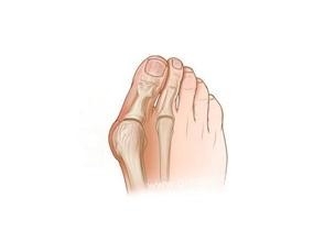 怎么优雅的穿高跟鞋,怎么优雅的穿高跟鞋走路