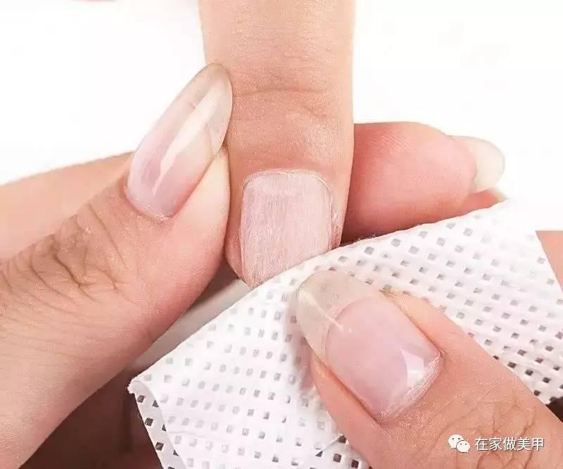 玛蒂被折断手指,玛蒂折断手指