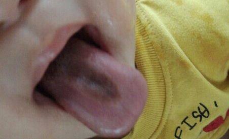 母乳宝宝体检不合格,母乳喂养的孩子健康吗