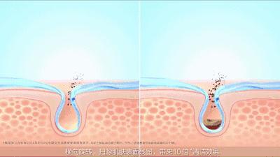 美容仪器真的有用？还是坑钱的噱头？