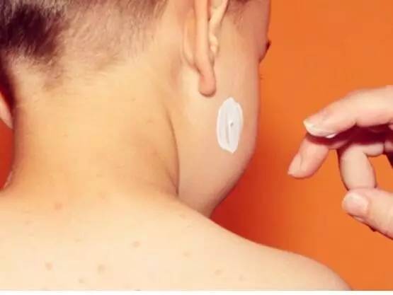 猩红热和手足口哪个可怕,小儿猩红热重型有多可怕