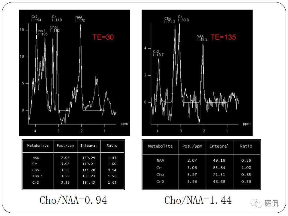神经系统解剖ppt课件,神经内科课件ppt