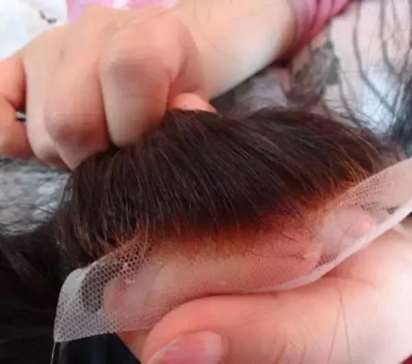 有白发植发和假发哪种好,植发和补发增发哪个好