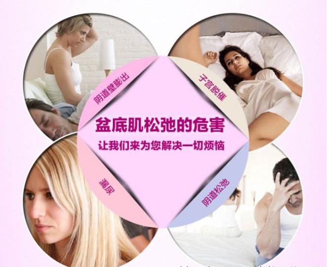 剖宫产到底要不要做盆底康复？