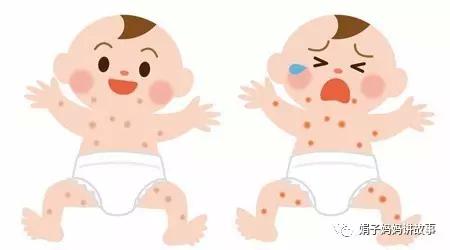 带小孩去医院看湿疹,湿疹最简单的自愈方法儿童