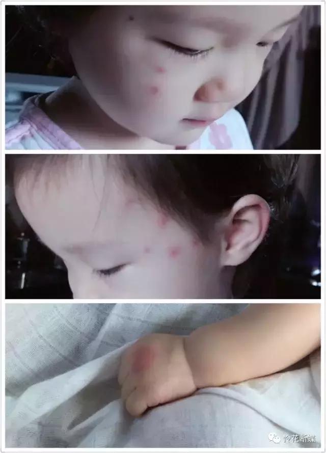 亲测10款驱蚊产品使用报告,10款驱蚊贴产品良心测评