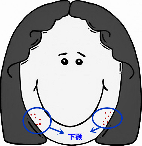 脸部痘痘看身体状况,超全面面部痘痘分析图文