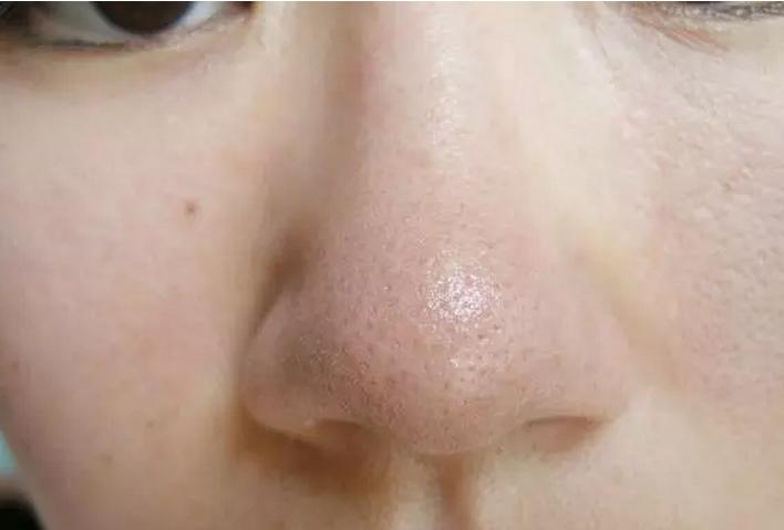 怎么去黑头收缩毛孔正确方法图解,hfp收缩毛孔去黑头套装用法及步骤