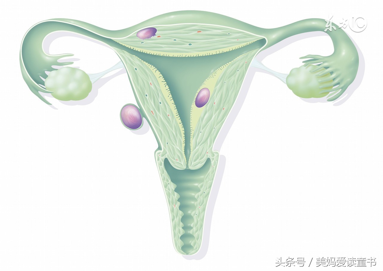 寰椾簡瀛愬鑲岀槫鍦ㄥ摢鍋氭墜鏈ソ,瀛愬鑲岀槫娌荤枟瀹ｄ紶