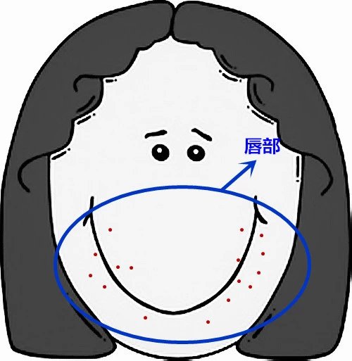 脸部痘痘看身体状况,超全面面部痘痘分析图文