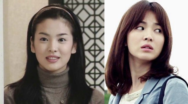 澶槼鐨勫悗瑁斿畫鎱т箶鐪肩嚎鐢绘硶,瀹嬫収涔斿お闃崇殑鍚庤鐪煎